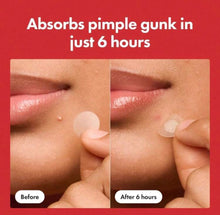 Load image into Gallery viewer, Mighty Patch Original